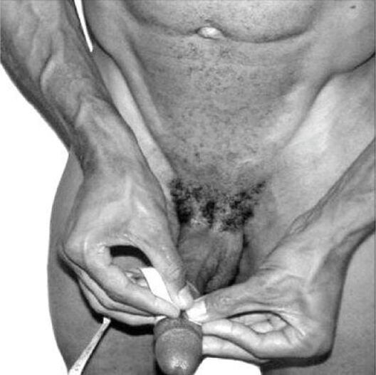 Mesure du pénis avant l'agrandissement